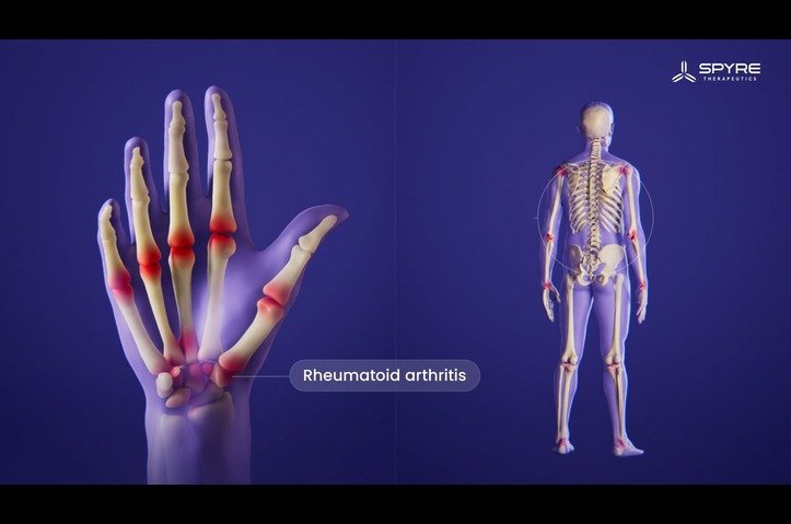 Spyre Therapeutics. 3D MoA Animation on SPY072 Targeting TL1A in Rheumatic Diseases by Visual Science